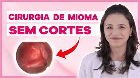 mioma submucoso