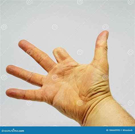 Missing Index Finger