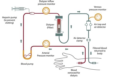 Modelling And Control Of Dialysis Systems Volume 1 Modeling Techniques Of Hemodialysis Systems Studies In Computational Intelligence