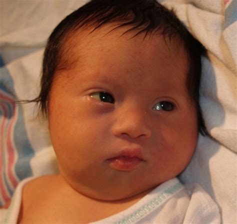 Mongoloid Baby