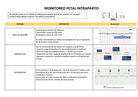 monitoria fetal categorias pdf