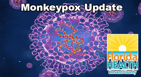 monkeypox outbreak florida