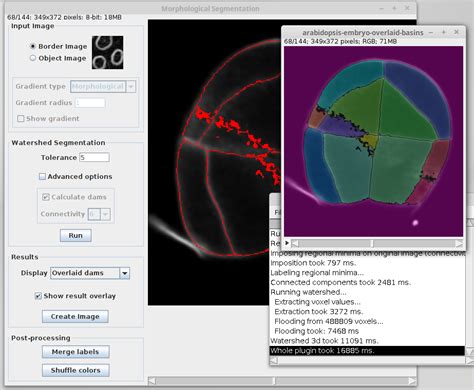 Morphological Segmentation Plugin Fiji