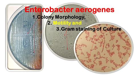 Morphology Of Enterobacter Aerogenes