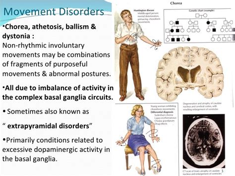 Movement Disorders Chorea