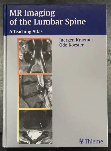 Read Mr Imaging Of The Lumbar Spine A Teaching Atlas 