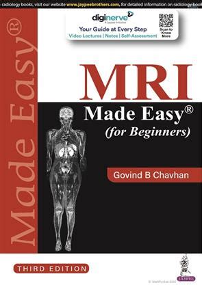 Read Mri Made Easy Govind Pdf 
