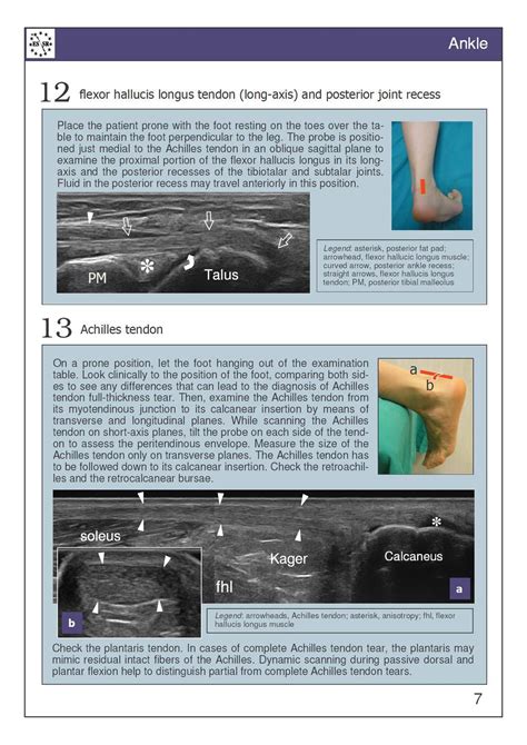 Read Musculoskeletal Ultrasound Technical Guidelines Vi Ankle 