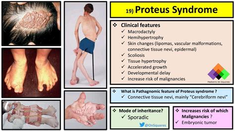 mutations and Proteus syndrome - The Lancet