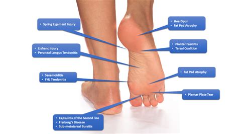 My Left Feet