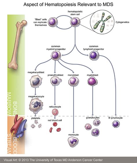 myelodysplastic syndrome - TheFreeDictionary.com