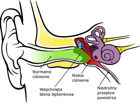 nagly ostry bol ucha