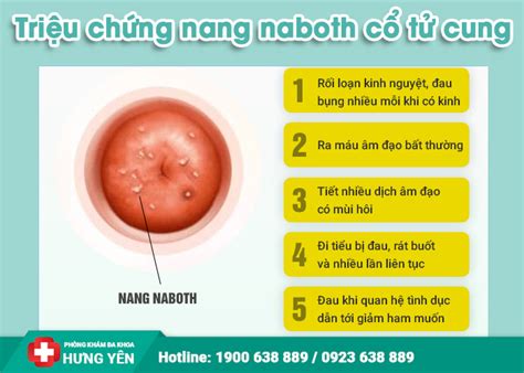 nang naboth cổ tử cung | 4 cch iu tr nang Naboth c