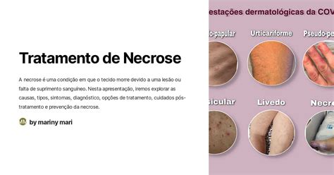 Necrose De Coagulação