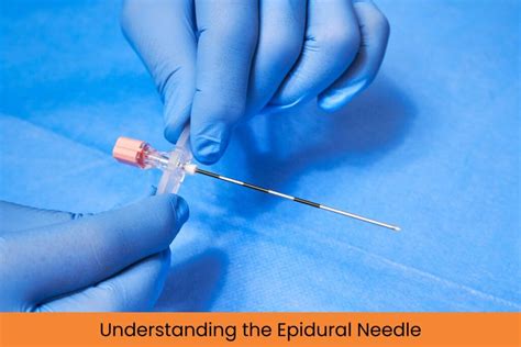 Needle Size For Epidural