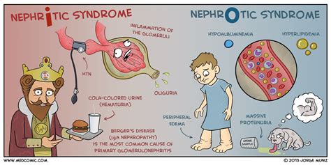 nefrotik syndrome icd 10