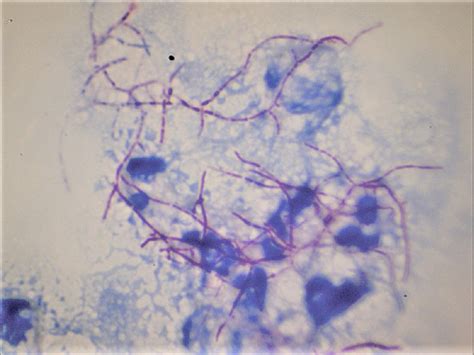 Neocardia - طريقة استخدام - الاصلي - ثمن - فوائد - ماهو - كم سعره - المغرب