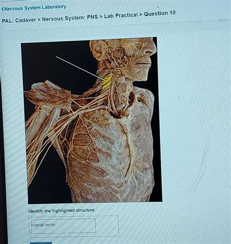 nervous system lab practical study guide