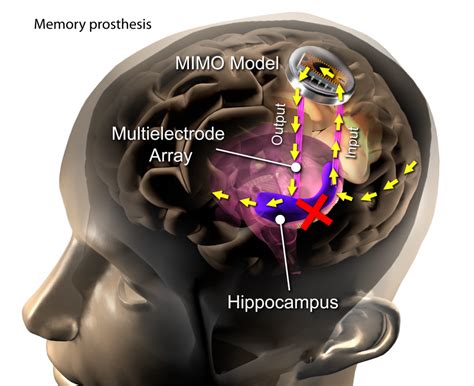 Read Neural Engineering 