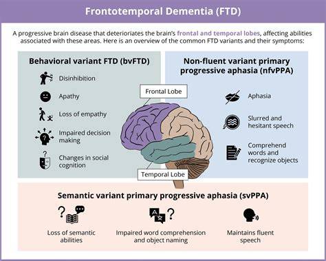 neuroimaging in dementia