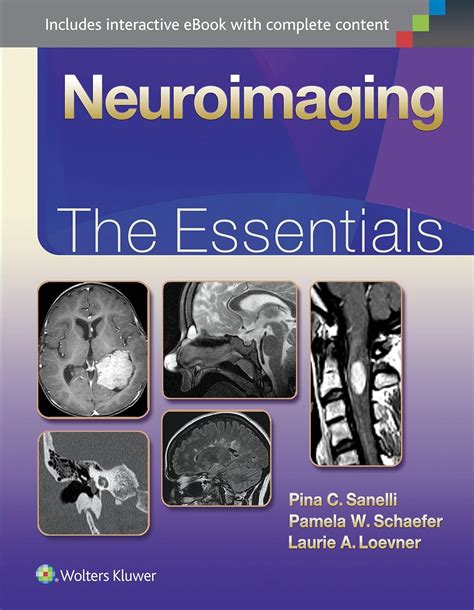 neuroimaging the essentials essentials series