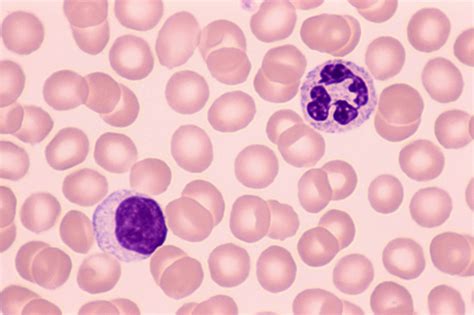 neutrophil lymphocyte ratio