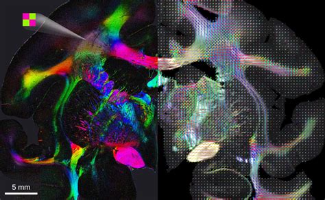 New Brain Imaging Techniques In Psychopharmacology British Association For Psychopharmacology Monographs