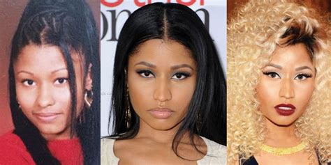 Nicki Minaj Surgery Before