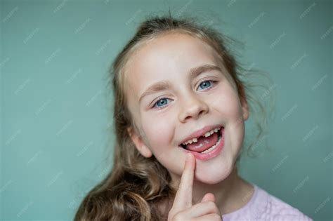 Niños Sin Dientes