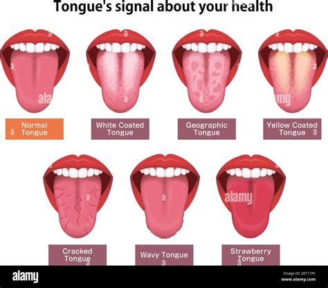normal colored tongue