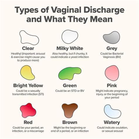normal discharge color