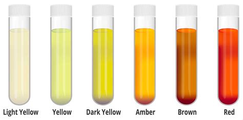 normal pee color