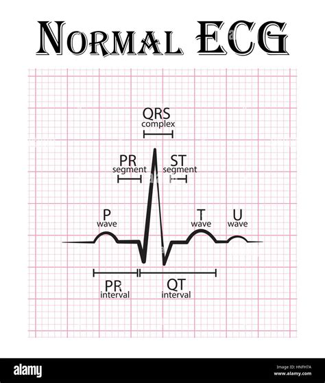 Normal Pr Interval