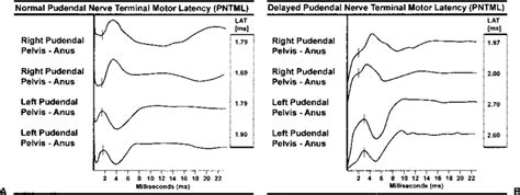 Normal Pudendal Nerve Terminal Motor Latency Value