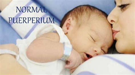 Normal Puerperium Ppt