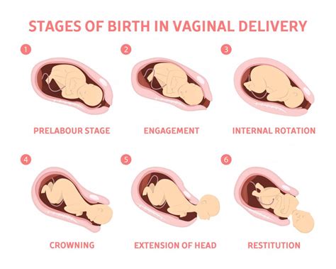 normal spontaneous delivery procedure - mchcb.com