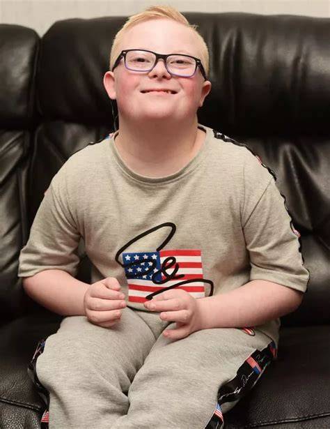 nude downs syndrome
