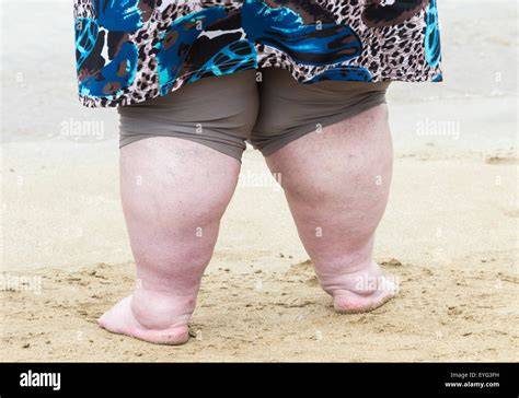 nude obese