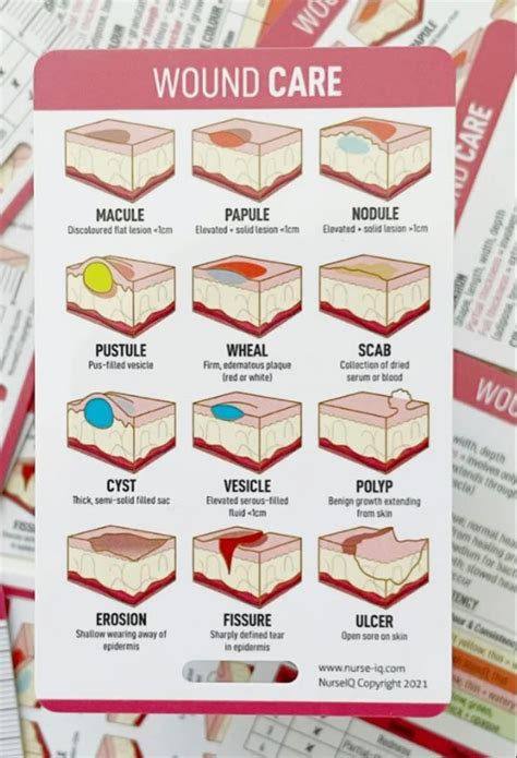 nursing wound care cheat sheet
