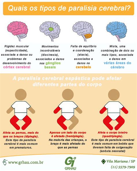 O Que E Paralexia