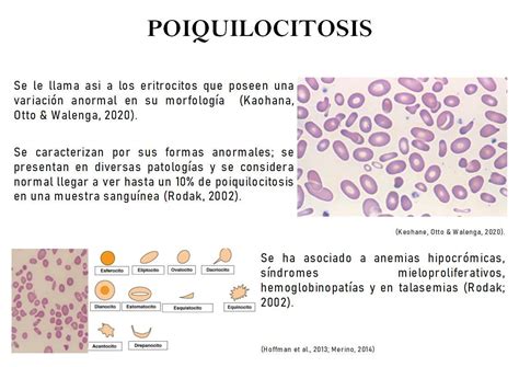 O Que é Piocitos