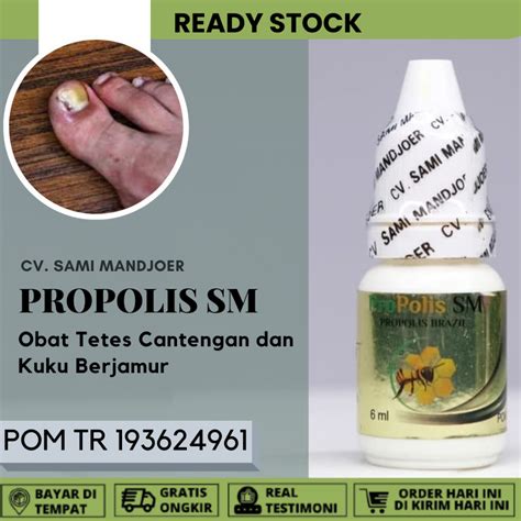 OBAT CANTENGAN JEMPOL KAKI 🧔 3 Obat Cantengan Jempol Kaki Paling Ampuh di Apotek