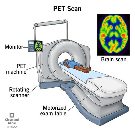 Objetive Pet Pet Test