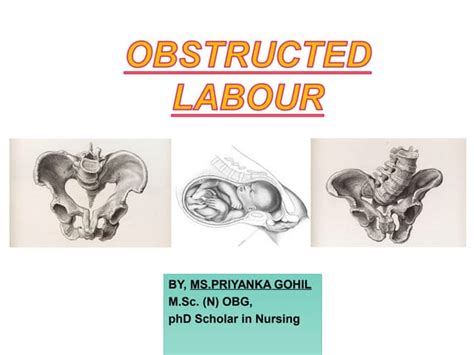 Obstructed Labour Meaning