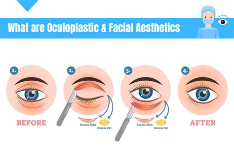 Oculoplastic Surgery