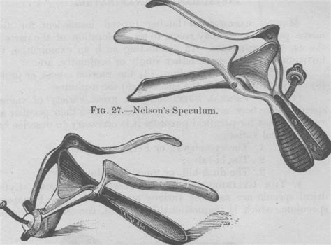 Read Online Old Speculum Pages Drawings 