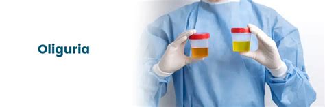 Oligoanuria Que Es