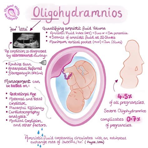 oligohidramnion