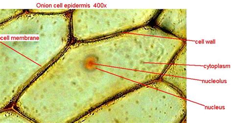 Onion Epidermal Cell Labeled