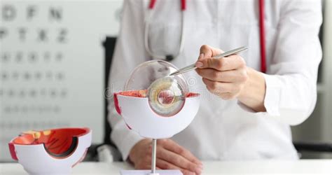 oogheelkundige terminologie